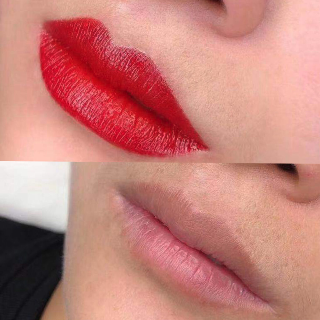 Lip coloring Before & After