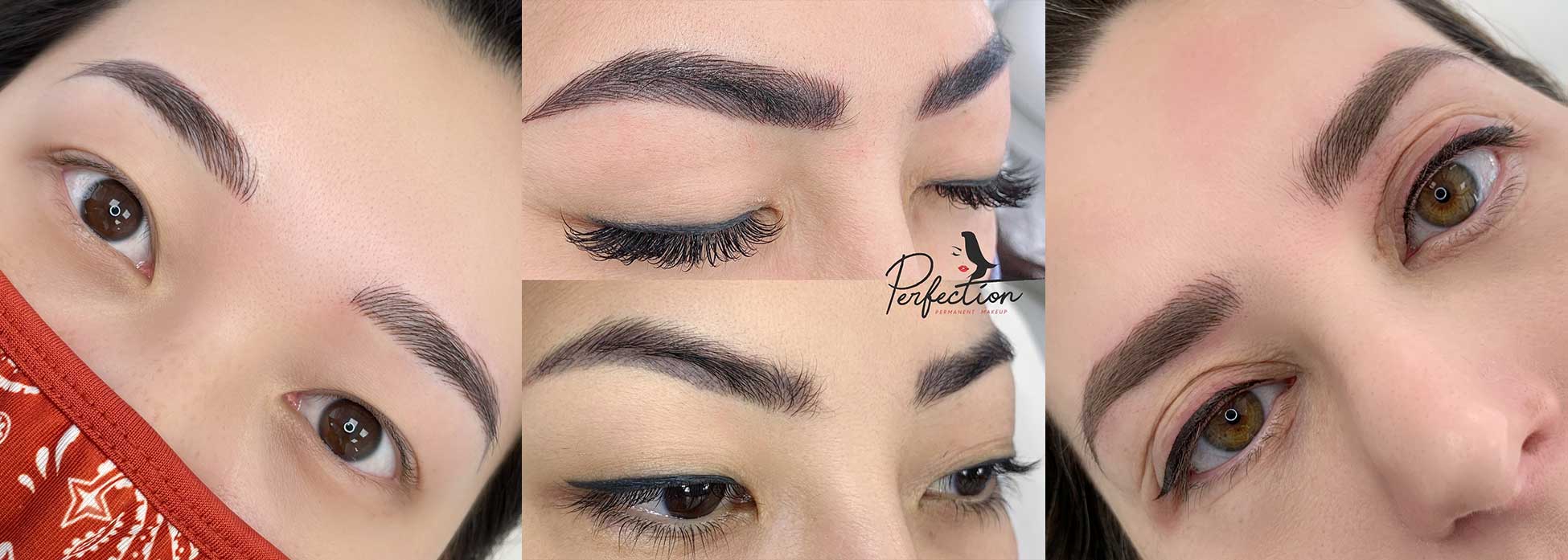 Eyebrow tattoo removal in progress⚡️Case: eyebrows done 8 years ago, 3  times. Based on a bluish color and density the ink was implanted way… |  Instagram